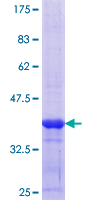 ab159322 on a 12.5% SDS-PAGE stained with Coomassie Blue.