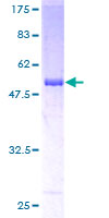 ab161253 on a 12.5% SDS-PAGE stained with Coomassie Blue.