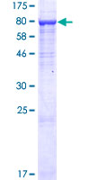 ab163207 on a 12.5% SDS-PAGE stained with Coomassie Blue.