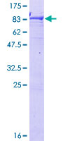 ab158104 on a 12.5% SDS-PAGE stained with Coomassie Blue.