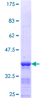 ab153610 on a 12.5% SDS-PAGE stained with Coomassie Blue.