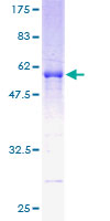 ab162417 on a 12.5% SDS-PAGE stained with Coomassie Blue.