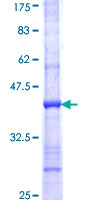 ab159323 on a 12.5% SDS-PAGE stained with Coomassie Blue.