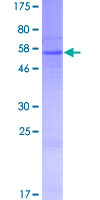 ab162354 on a 12.5% SDS-PAGE stained with Coomassie Blue.