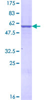 ab153180 on a 12.5% SDS-PAGE stained with Coomassie Blue.