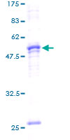 ab153181 on a 12.5% SDS-PAGE stained with Coomassie Blue.