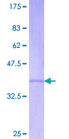 ab160744 on a 12.5% SDS-PAGE stained with Coomassie Blue.