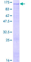 ab160023 on a 12.5% SDS-PAGE stained with Coomassie Blue.