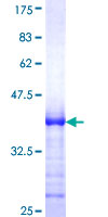 ab160024 on a 12.5% SDS-PAGE stained with Coomassie Blue.