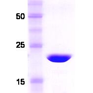 14% SDS-PAGE gel loaded with recombinant human Recoverin protein. Predicted molecular weight 23.1 kDa.