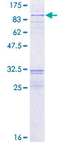 ab159324 on a 12.5% SDS-PAGE stained with Coomassie Blue.