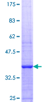 ab159325 on a 12.5% SDS-PAGE stained with Coomassie Blue.