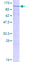 ab157847 on a 12.5% SDS-PAGE stained with Coomassie Blue.