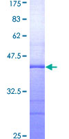 ab157848 on a 12.5% SDS-PAGE stained with Coomassie Blue.