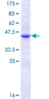 ab159907 on a 12.5% SDS-PAGE stained with Coomassie Blue.