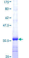 ab159908 on a 12.5% SDS-PAGE stained with Coomassie Blue.