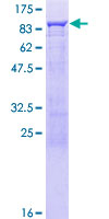 ab152653 on a 12.5% SDS-PAGE stained with Coomassie Blue.