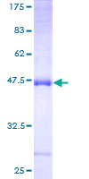 ab159350 on a 12.5% SDS-PAGE stained with Coomassie Blue.