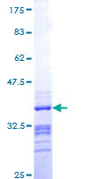 ab162494 on a 12.5% SDS-PAGE stained with Coomassie Blue.