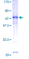 ab162179 on a 12.5% SDS-PAGE stained with Coomassie Blue.