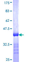 ab162180 on a 12.5% SDS-PAGE stained with Coomassie Blue.