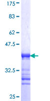 ab160372 on a 12.5% SDS-PAGE stained with Coomassie Blue.