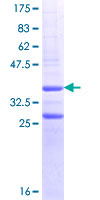 ab153434 on a 12.5% SDS-PAGE stained with Coomassie Blue.