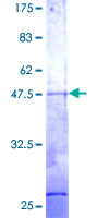 ab161286 on a 12.5% SDS-PAGE stained with Coomassie Blue.