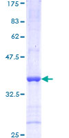 ab152654 on a 12.5% SDS-PAGE stained with Coomassie Blue.