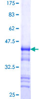 ab159467 on a 12.5% SDS-PAGE stained with Coomassie Blue.