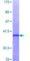 ab159316 on a 12.5% SDS-PAGE stained with Coomassie Blue.