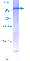 ab159310 on a 12.5% SDS-PAGE stained with Coomassie Blue.