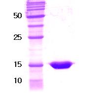 14% SDS-PAGE gel loaded with recombinant human Retinoid X Receptor alpha protein.