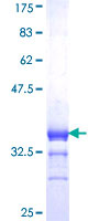 ab159468 on a 12.5% SDS-PAGE stained with Coomassie Blue.