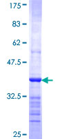 ab159329 on a 12.5% SDS-PAGE stained with Coomassie Blue.
