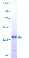 ab161861 on a 12.5% SDS-PAGE stained with Coomassie Blue.