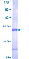 ab161862 on a 12.5% SDS-PAGE stained with Coomassie Blue.