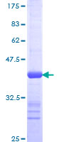 ab159330 on a 12.5% SDS-PAGE stained with Coomassie Blue.