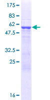 ab161127 on a 12.5% SDS-PAGE stained with Coomassie Blue.