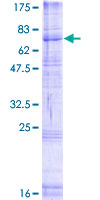 ab164884 on a 12.5% SDS-PAGE stained with Coomassie Blue.