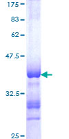 ab159333 on a 12.5% SDS-PAGE stained with Coomassie Blue.