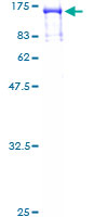ab159335 on a 12.5% SDS-PAGE stained with Coomassie Blue.