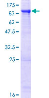 ab159337 on a 12.5% SDS-PAGE stained with Coomassie Blue.