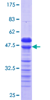 ab160118 on a 12.5% SDS-PAGE stained with Coomassie Blue.