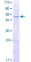 ab162898 on a 12.5% SDS-PAGE stained with Coomassie Blue.