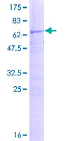 ab165699 on a 12.5% SDS-PAGE stained with Coomassie Blue.