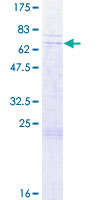 ab164485 on a 12.5% SDS-PAGE stained with Coomassie Blue.