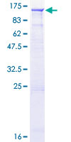 ab161561 on a 12.5% SDS-PAGE stained with Coomassie Blue.