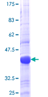 ab161562 on a 12.5% SDS-PAGE stained with Coomassie Blue.