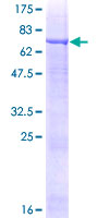 ab166102 on a 12.5% SDS-PAGE stained with Coomassie Blue.